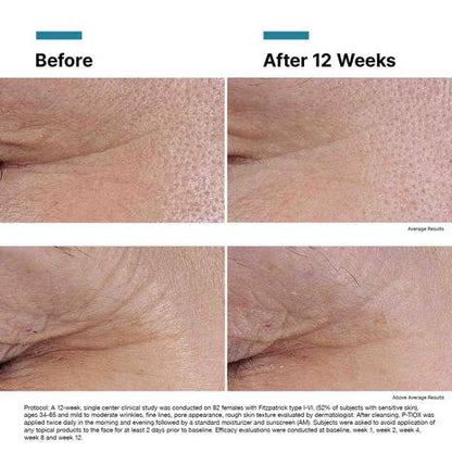 SkinCeuticals P-TIOX Wrinkle Modulating Peptide Serum 1.0 fl oz